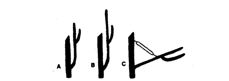An illustration showing correct limb-spreading