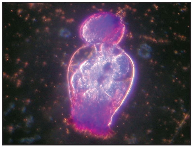 Stained rotifer with egg.
