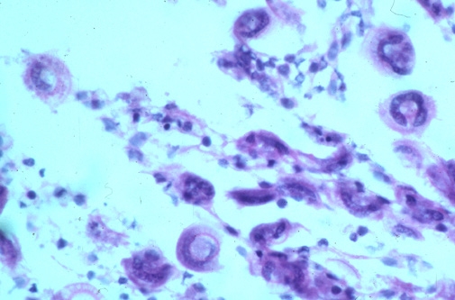 microscope images of Histopathology of Trichodina sp. in gill tissue of fish