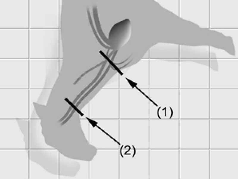 A diagram of an unconscious sheep or goat with blood vessels. One line points under its chin, and another at the base of the neck, both intersecting into major blood vessels. (Rectangle)