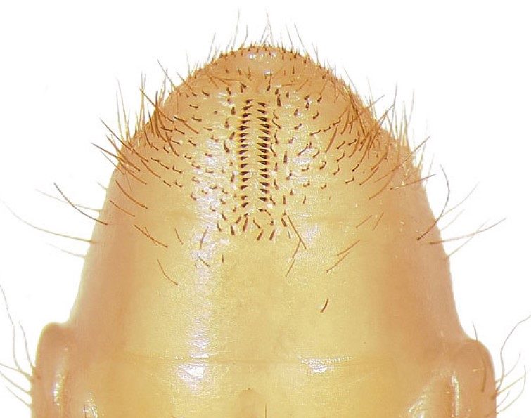 Close-up image of a raster with fine hairs and detailed patterns.