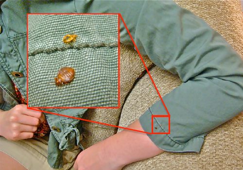phcture of a bed bug on the seam of a shirt