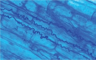 Microscopic image of an endophyte.